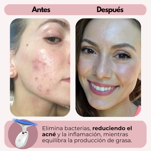 SkinLift™ - Rejuvenece tu piel desde casa