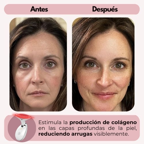 SkinLift™ - Rejuvenece tu piel desde casa
