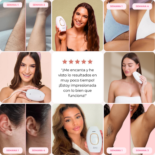 GlowSphere™ Depilación IPL profesional en casa