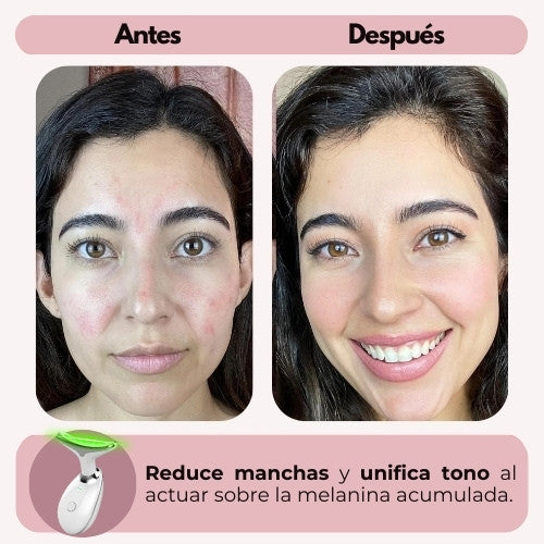 SkinLift™ - Rejuvenece tu piel desde casa