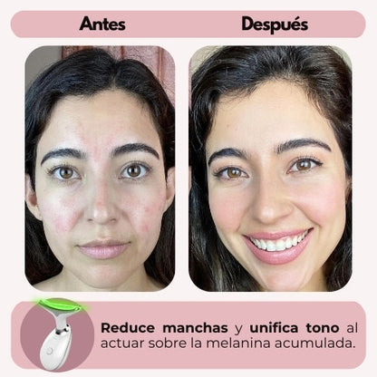 SkinLift™ - Rejuvenece tu piel desde casa
